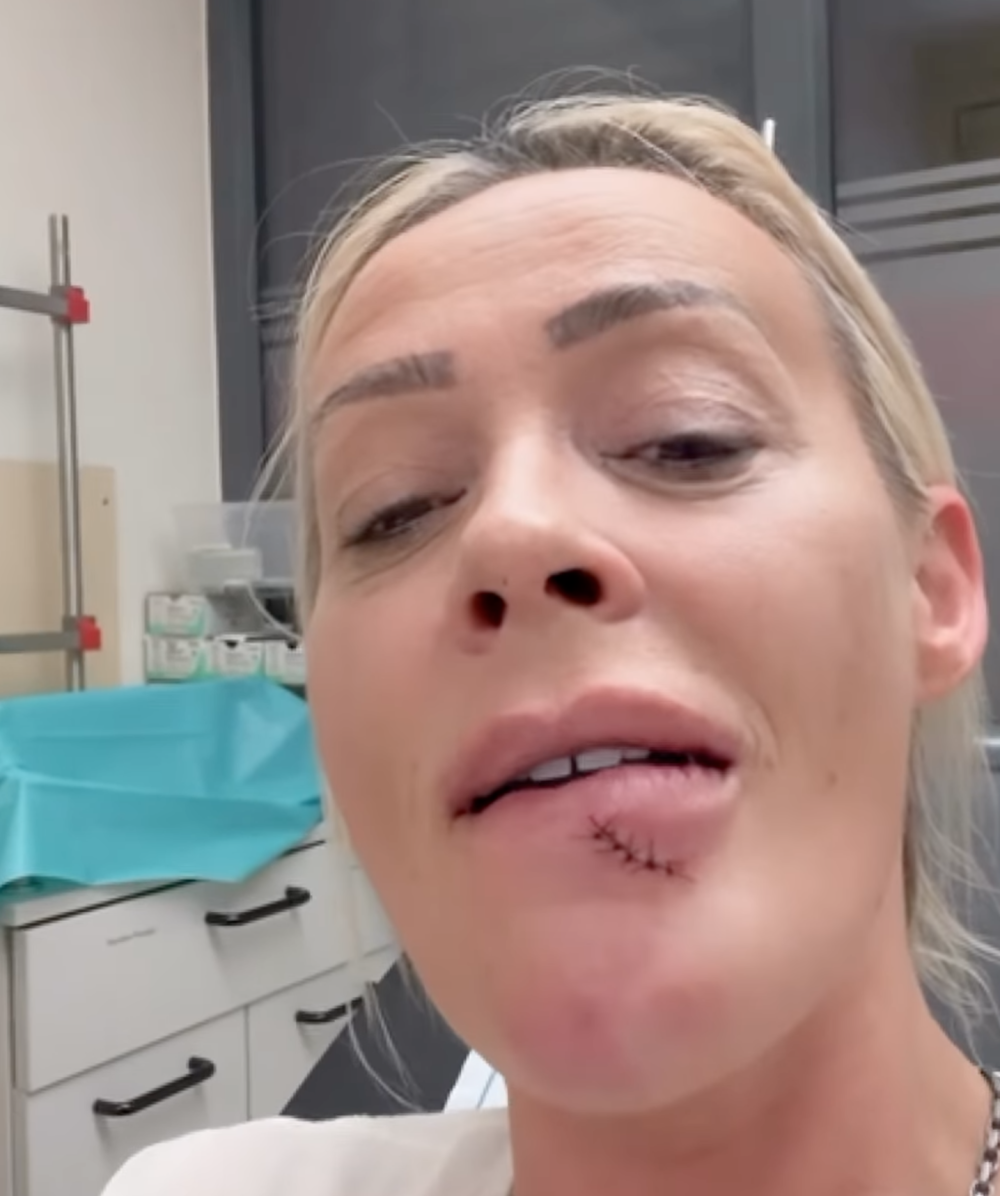 Schock für Cora Schumacher: Notaufnahme mitten in der Nacht!