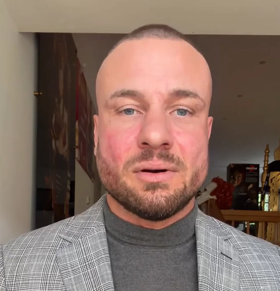 „Gespräche illegal gestreamt“: Eric Sindermann rechnet mit René Redo ab