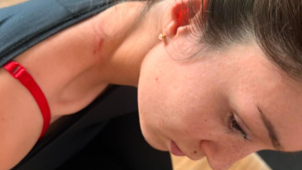 "Wurde häufiger geschlagen„: Medizinisches Gutachten dokumentiert Verletzungen von Julia Meck