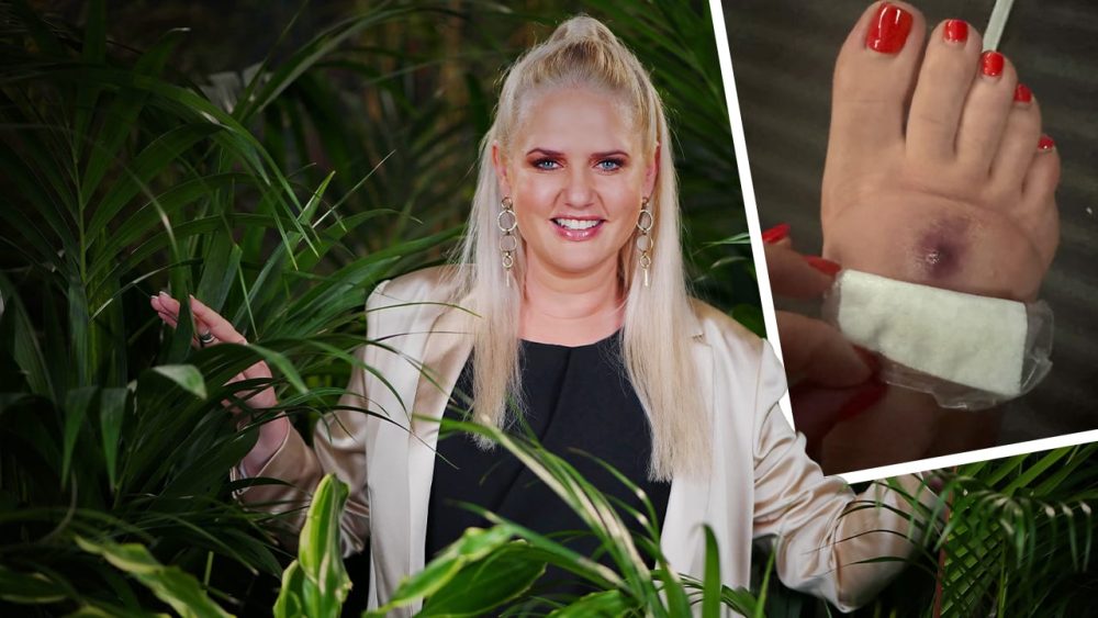 Sarah Knappik leidet unter schmerzhaftem Kriebelmückenbiss: „Es ist ein Albtraum“