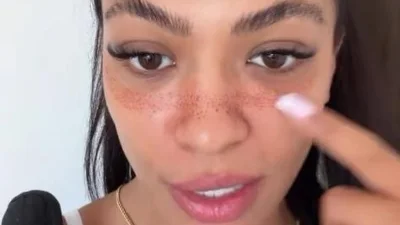 Hati Suarez erntet Spott für Fake-Sommersprossen