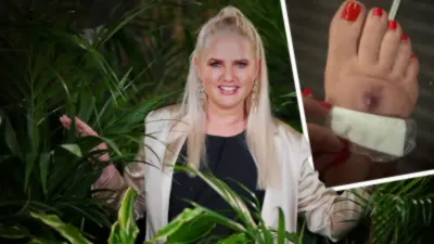 Sarah Knappik leidet unter schmerzhaftem Kriebelmückenbiss: „Es ist ein Albtraum“