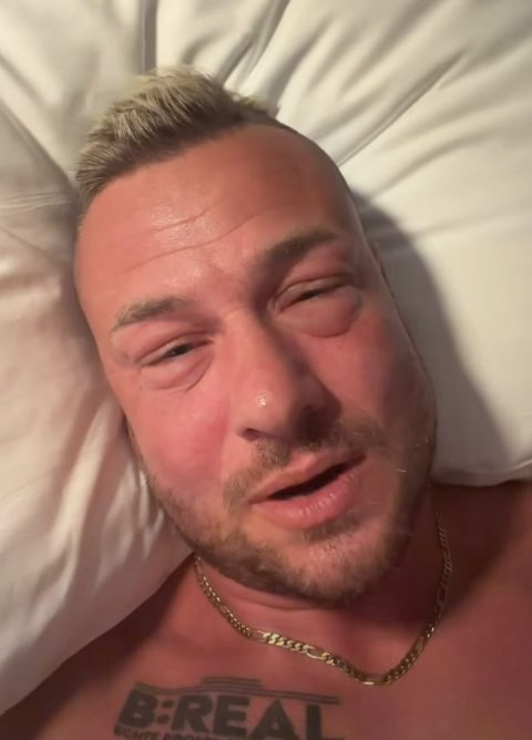 Eric Sindermann nach Shisha-Bar-Besuch kaum wiederzuerkennen: Gesicht extrem geschwollen