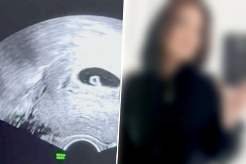 Pia Babu trauert um ihr ungeborenes Kind nach Fehlgeburt