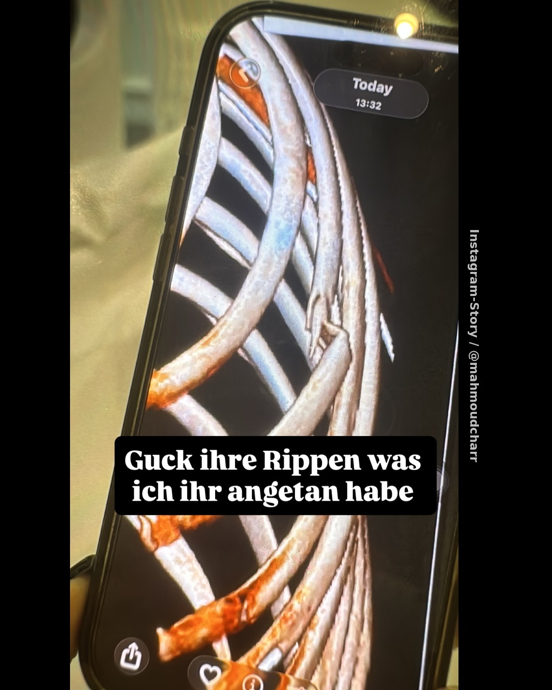 Schockierende Vorwürfe und Klinik-Bilder: Fremdgeh- und Gewaltdrama um Mahmoud Charr und Ehefrau Marina